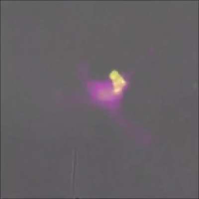 T-cell killing a cancer cell