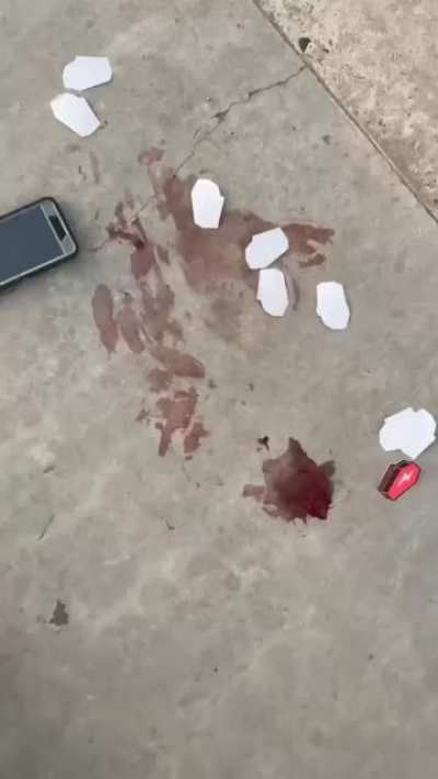 Skateboard to the face (Knock Out)