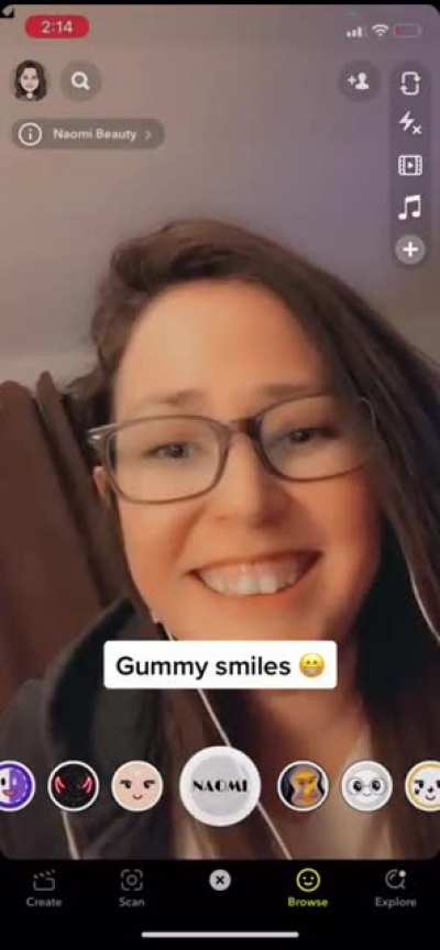 Gummy Smile