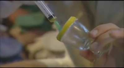 Effect of Snake venom on blood.