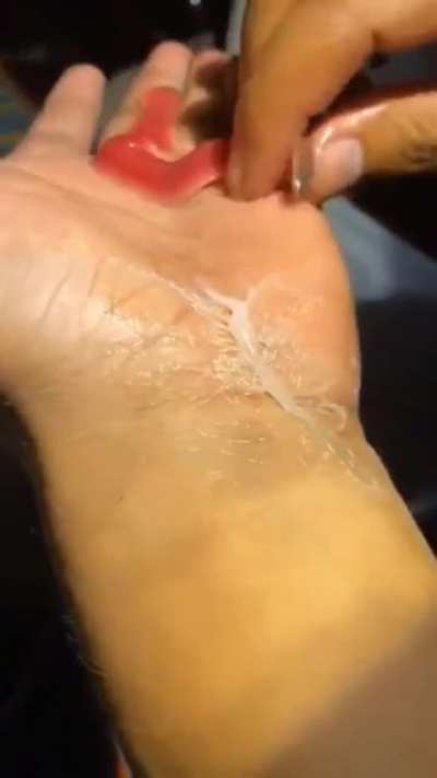 Worm