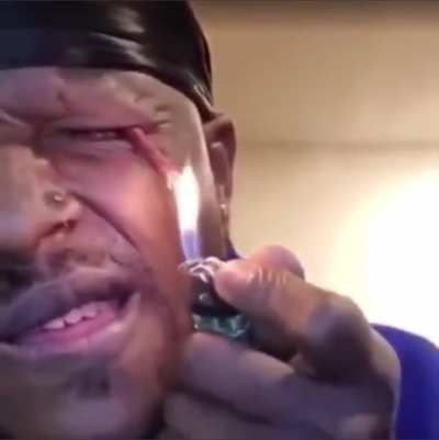 And that’s how I lost my bloody eye.