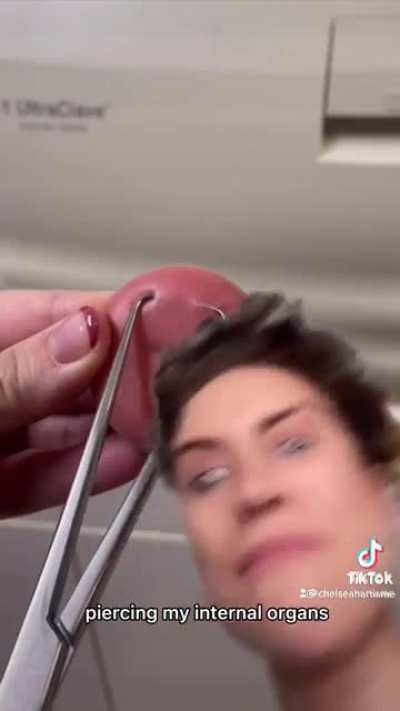 IUD insertion is barbaric. Please join the campaign for adequate pain management during painful procedures instead of telling women it’s “just a pinch”