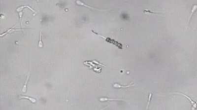 A nanobot picks up a lazy sperm by the tail and inseminates an egg with it