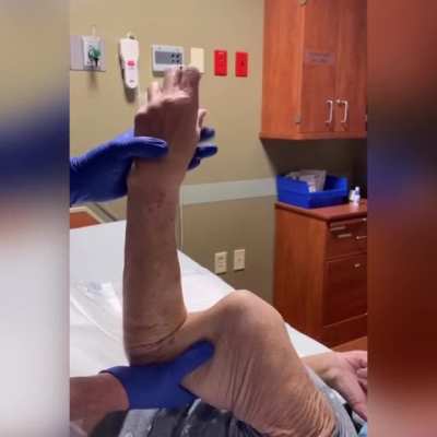 This Womans Arm