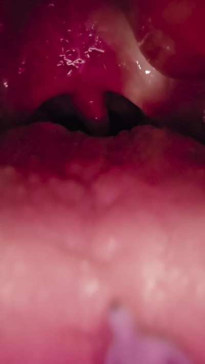 Yumm