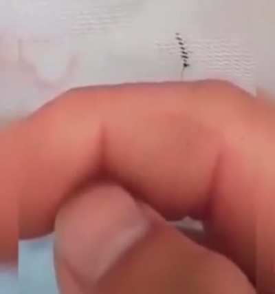 F**k you, mosquito.