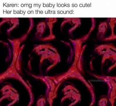 Ultrasound