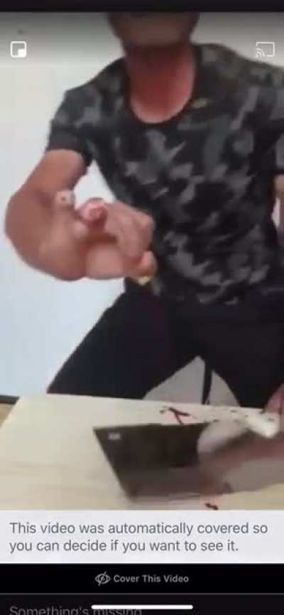 Man chops off his finger to prove sharpness of the blade