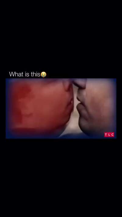 WHAT 😭