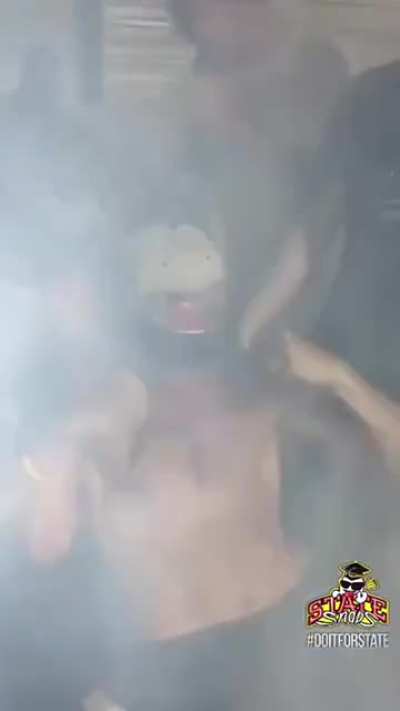 HMFT after I get 5th degree burns on my chest