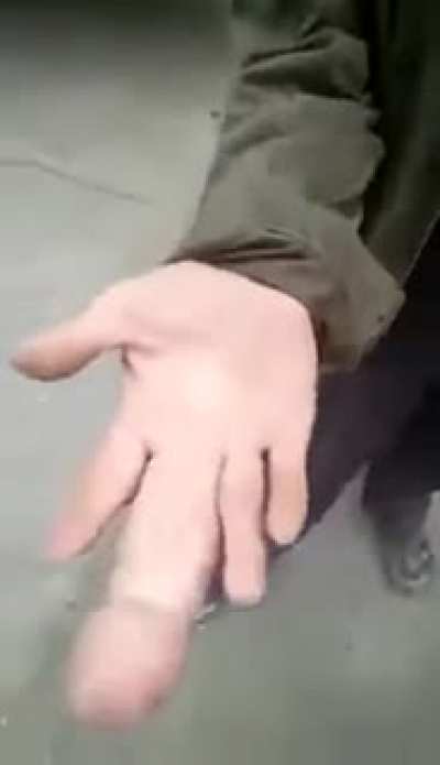 MANO PENE PENE MANO