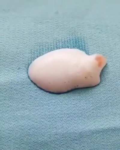Hydrogen Peroxide helps remove stains in one go...
