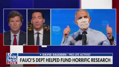 Dr Fauci’s NIAID purchased severed heads of aborted babies and grafted their scalps onto lab rats