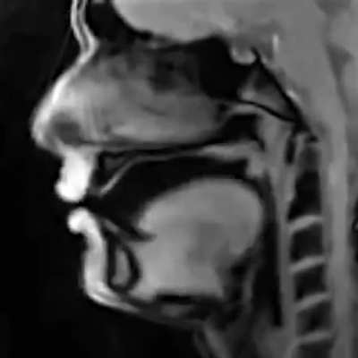 A MRI of an actual person talking