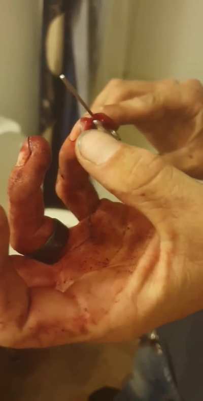 Back when I cut the tip off of my pinky and had to trim the excess flesh.