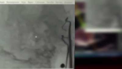 Russian boat full of infantry hits a Ukrainian anti-landing mine 