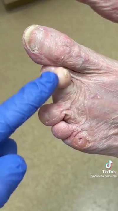 Eww