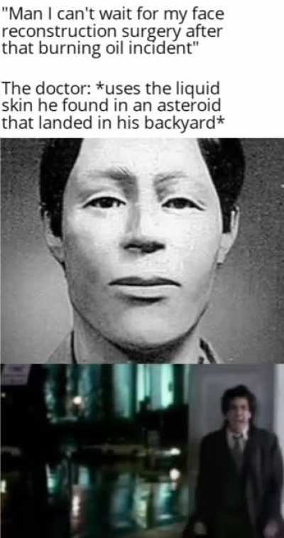 It... it ate his personality. He wasn't the same after that surgery. He wasn't even a person anymore. Just a walking, vegetating lump of flesh.