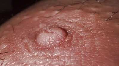 Nipple or Alien life-form? Why does it look like that!