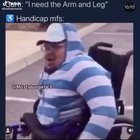 Arm and leg !
