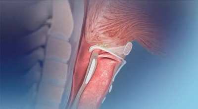 The Epiglottis, a flap of cartilage that seals off the windpipe while eating