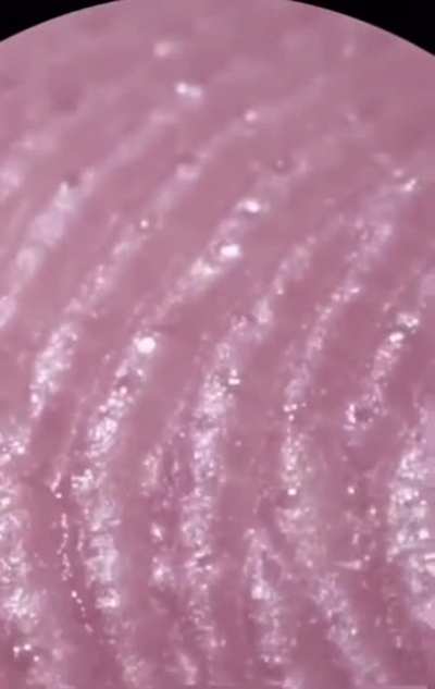 How a finger print looks like under a microscope
