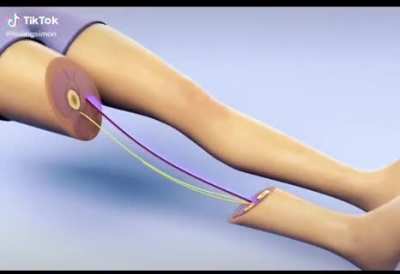 How to fix a leg from 5 minute crafts