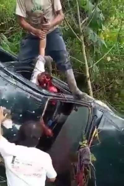 Nasty car crash leaves victim’s skull and loose face hanging from remaining tissue.