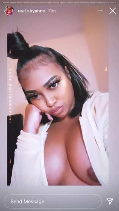 🥴