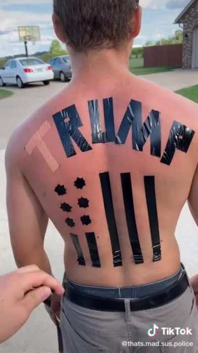 Getting skin cancer to own the libs 😤😤