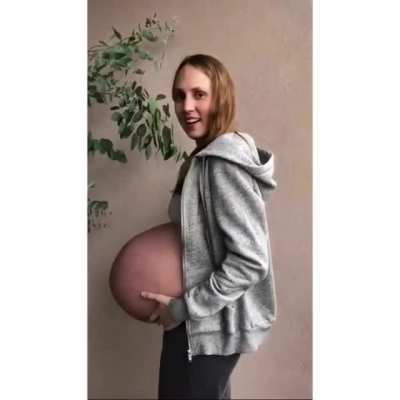 Pregnant woman with triplets at 33 plus 4 weeks