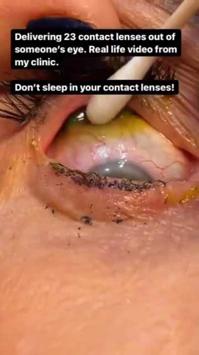How ?