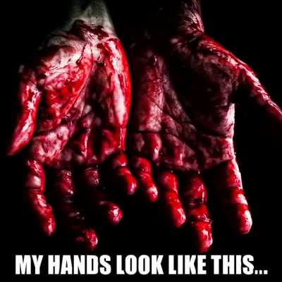 My hands look like this