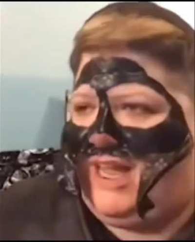 Shills Blackhead Remover