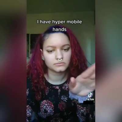 lmao that’s NOT hypermobility…pretty sure most ppl can do this anyway