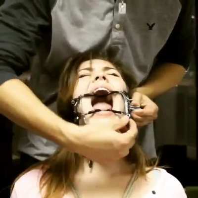 Open mouth gag