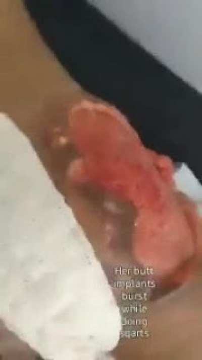 Hell of a fleshwound