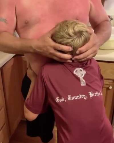 Positive use of sunburn
