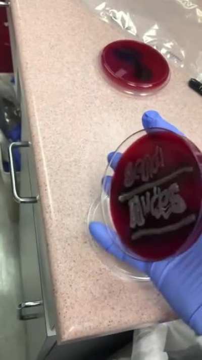 Bacteria growing in strange lines.