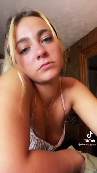 Omg😱
