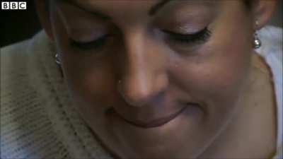 Foreign accent syndrome