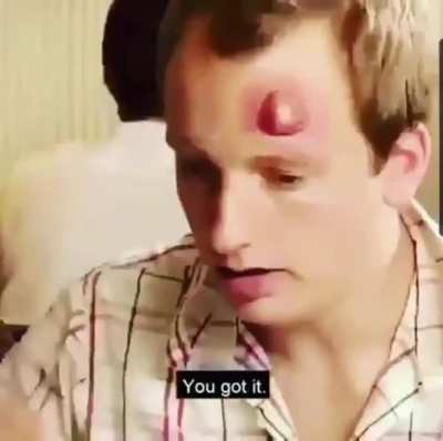 Ouchie