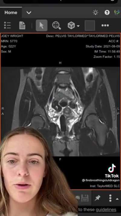 Insurance wouldn't cover her for a 'Women's health's check-up because the hospital listed her as male