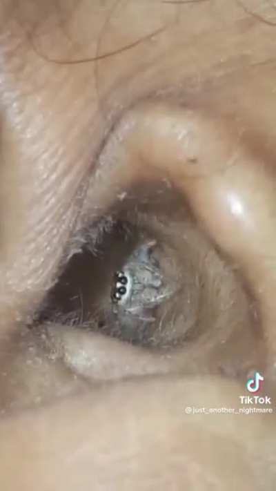 the itsy bitsy spider