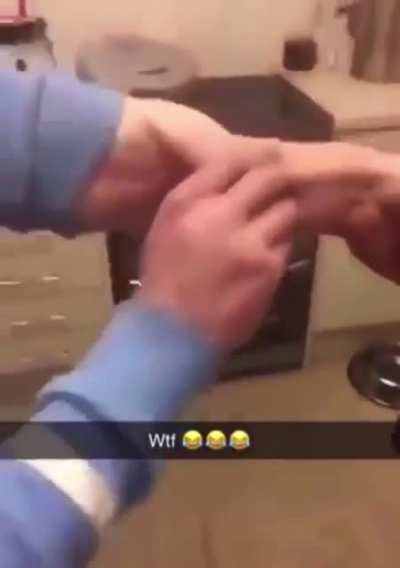 Dickhead