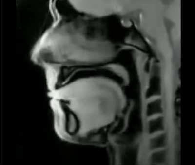 MRI of a person speaking (found it really interesting)