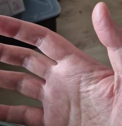 My finger has been doing this on and off all afternoon.