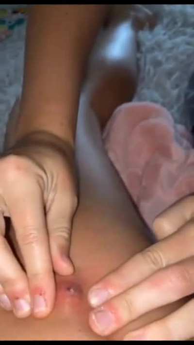 Squeeze