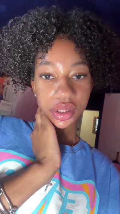 some braces on her would be crazy omg